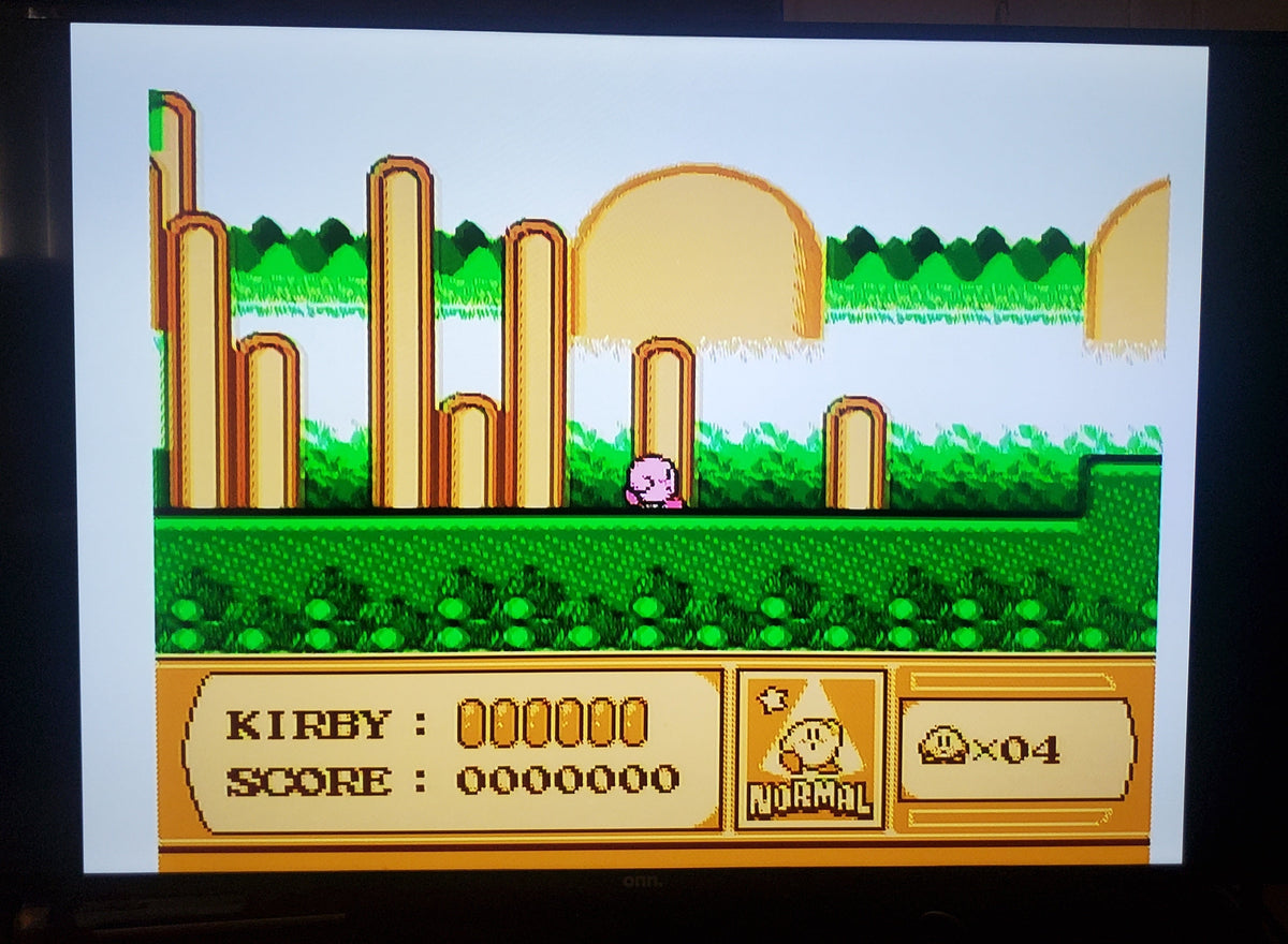 Kirby's Adventure — NES (Reproduction)